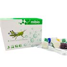 E蛋白(GSDME)人試劑盒 酶聯(lián)生物提供高